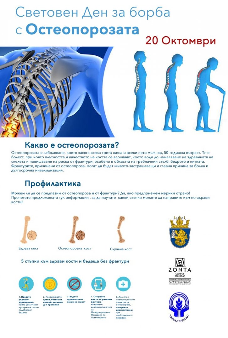 УМБАЛ Бургас се включва в отбелязването на Световния ден за борба срещу остеопорозата - E-Burgas.com