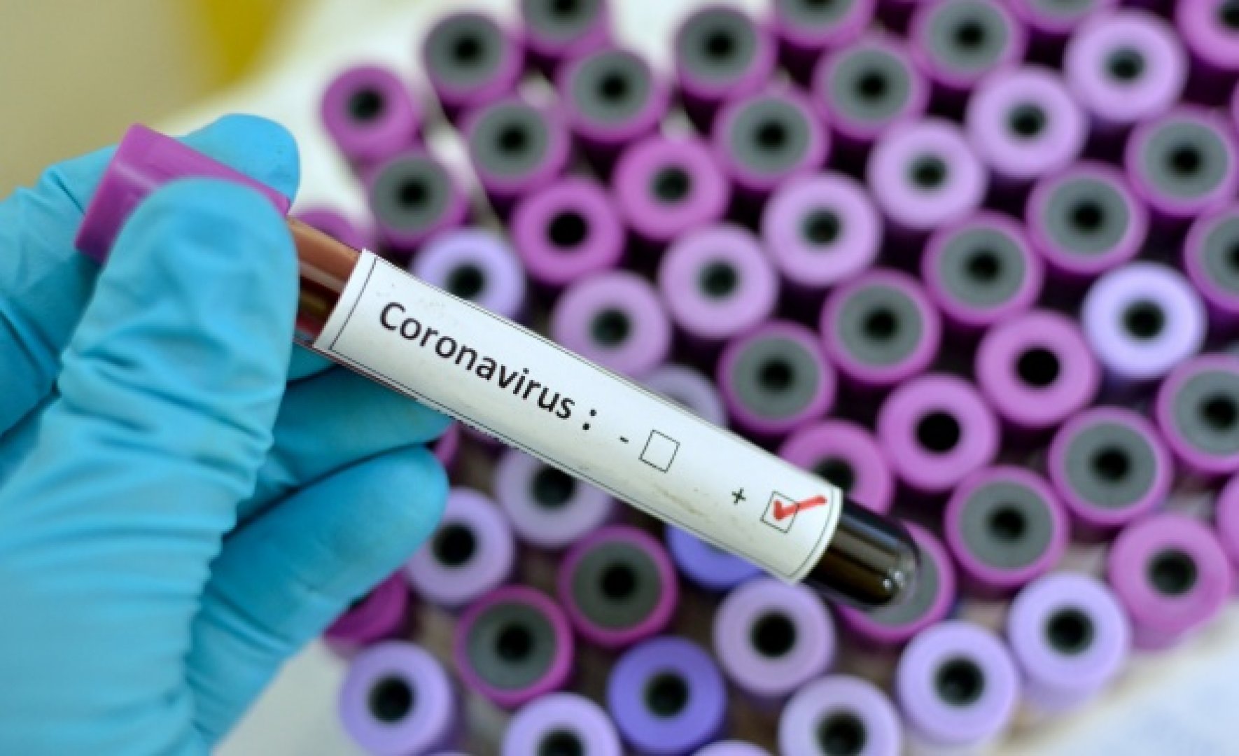 Първа жертва на коронавируса в Европа - E-Burgas.com