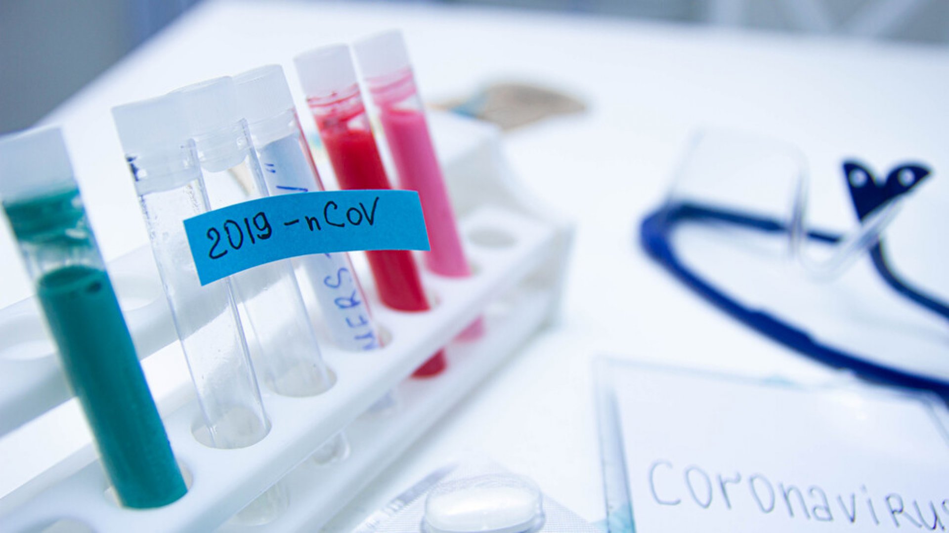 Учени създадоха бърз тест за коронавируса - E-Burgas.com