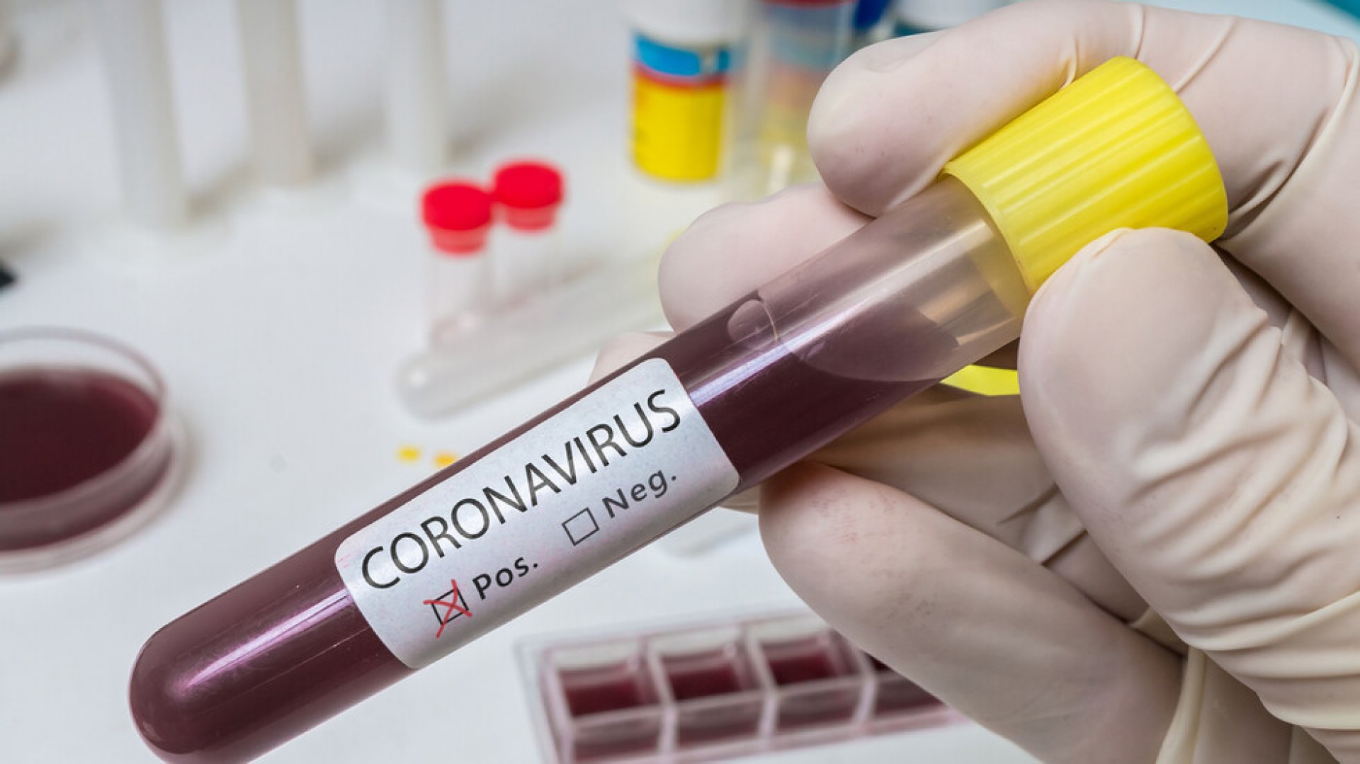 Расте броят на заразените с COVID-19 в Русия и Украйна - E-Burgas.com