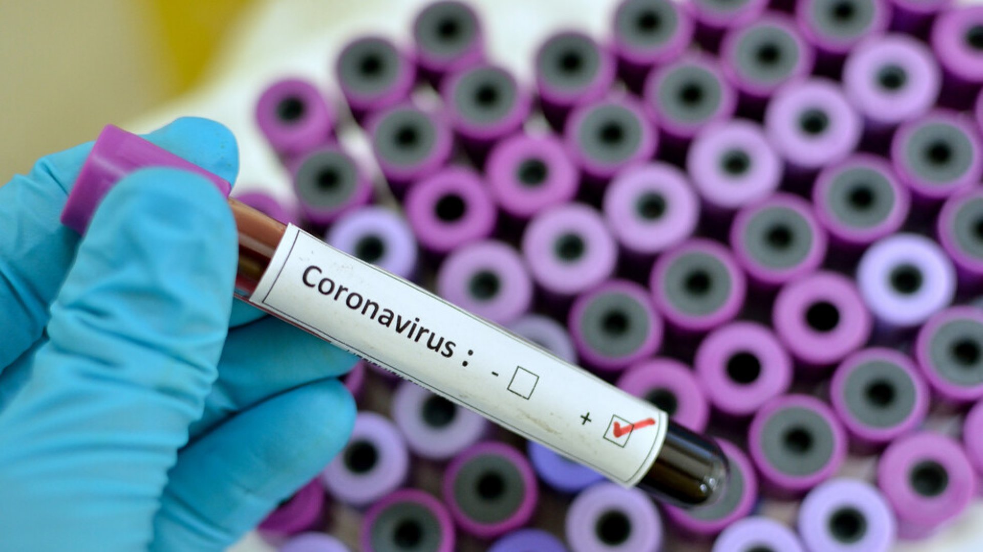 18 нови случая на коронавирус днес - E-Burgas.com