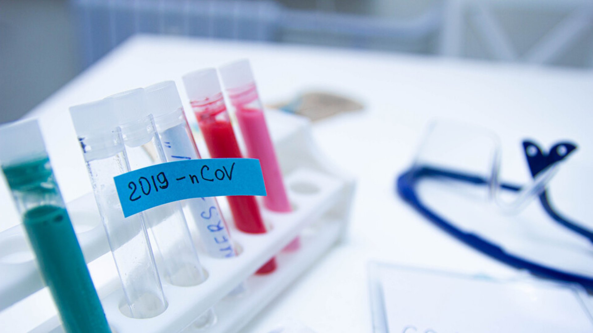 По какъв начин се взимат пробите за коронавирус? - E-Burgas.com
