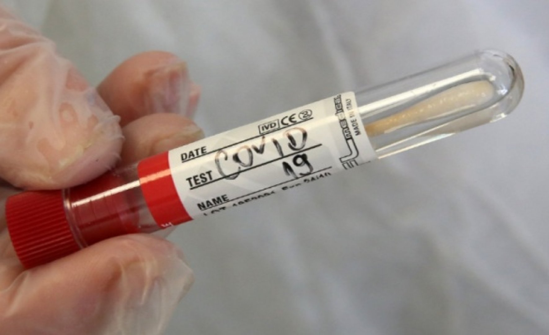 Разполагаме с 60 хиляди теста за коронавирус - E-Burgas.com