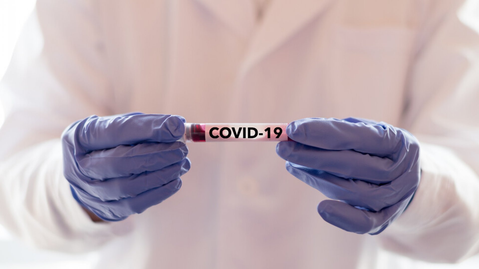 Европа в търсене на ваксина срещу COVID-19 - E-Burgas.com