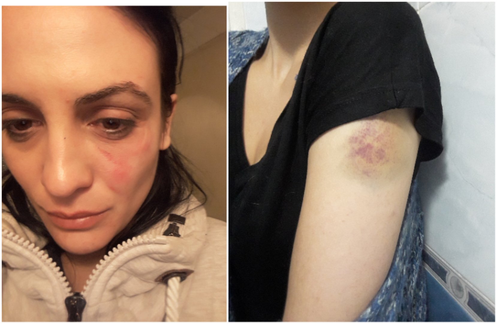 Актрисата Диана Димитрова: Бях бита по време на снимки, а на един човек се измъкна безнаказано  - E-Burgas.com