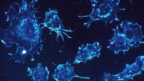 Лаборатория „ЛИНА”  разшири обхвата на генетичните изследвания, показващи риска от тромбоза - E-Burgas.com
