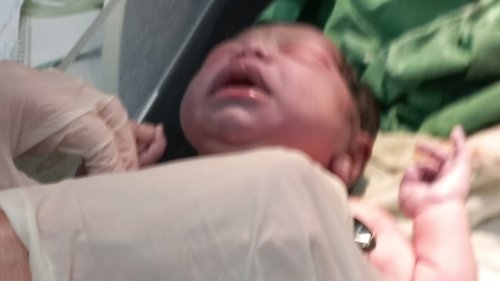 Жена с коронавирус роди в Гърция - E-Burgas.com