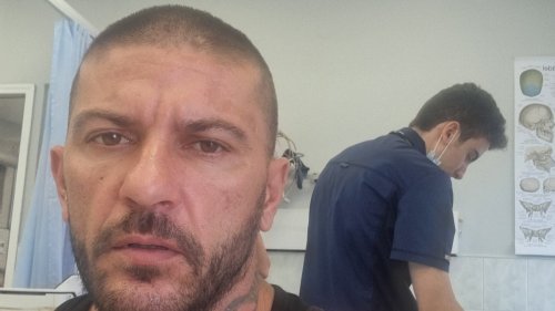 На снимката потърпевшия на преглед в УМБАЛ Бургас 